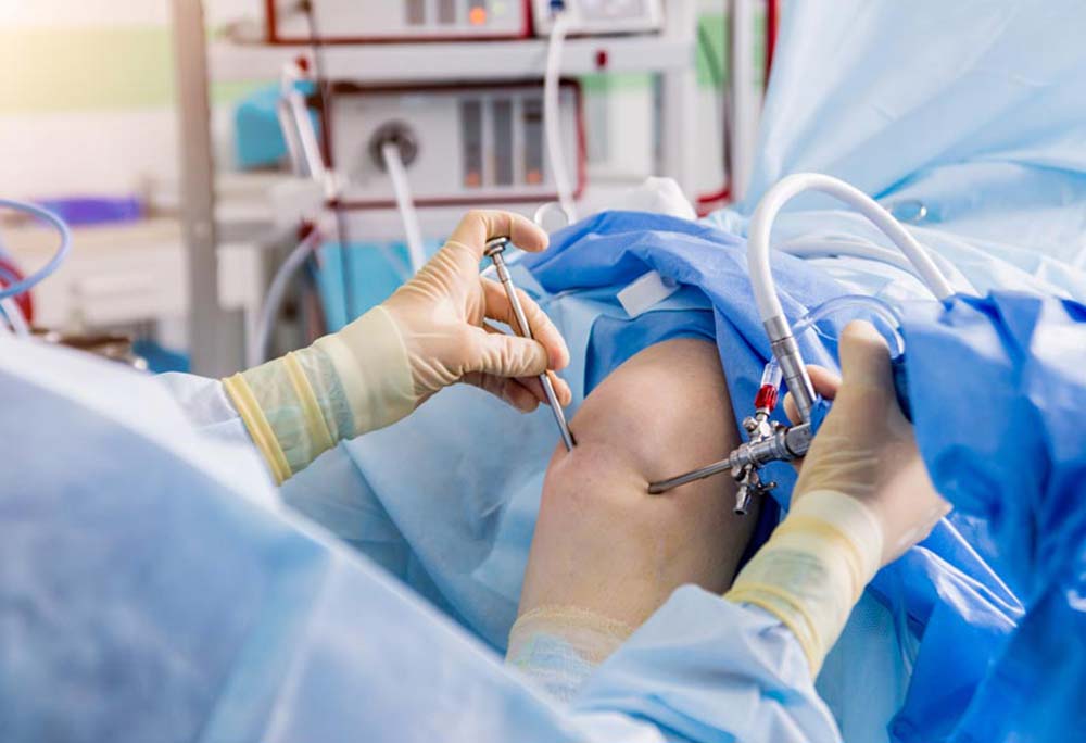 Arthroscopy
